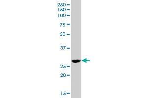 DHRS4 MaxPab polyclonal antibody. (DHRS4 抗体  (AA 1-278))