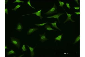 Immunofluorescence of monoclonal antibody to RING1 on HeLa cell. (RING1 抗体  (AA 81-170))