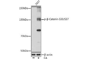 Western blot analysis of extracts of 293T cells, using Phospho-β-Catenin-S33/S37 Rabbit mAb (ABIN7266140) at 1:1000 dilution. (CTNNB1 抗体  (pSer33, pSer37))
