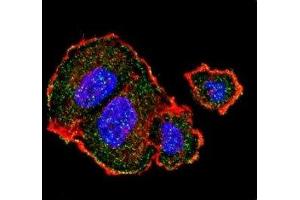 Confocal immunofluorescent analysis of p-Tuberin antibody with MCF-7 cells followed by Alexa Fluor 488-conjugated goat anti-rabbit lgG (green). (Tuberin 抗体  (pSer939))