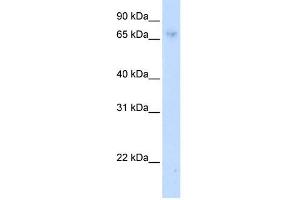 WB Suggested Anti-ZNF432 Antibody Titration:  0.