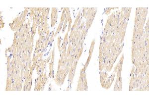 Detection of HMGCR in Rat Cardiac Muscle Tissue using Polyclonal Antibody to 3-Hydroxy-3-Methylglutaryl Coenzyme A Reductase (HMGCR) (HMGCR 抗体  (AA 638-887))