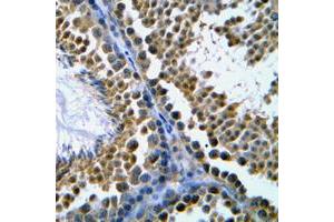 Immunohistochemical analysis of Topoisomerase 2 beta staining in human tonsil formalin fixed paraffin embedded tissue section. (TOP2B 抗体  (N-Term))