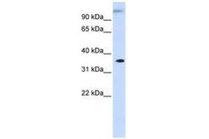 Image no. 1 for anti-Dihydrodiol Dehydrogenase (Dimeric) (DHDH) (AA 252-301) antibody (ABIN6741277) (DHDH 抗体  (AA 252-301))