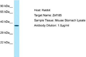 Host: Rabbit Target Name: Znf185 Sample Type: Mouse Stomach lysates Antibody Dilution: 1. (Zinc Finger Protein 185 抗体  (Middle Region))