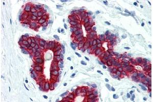 Human Breast (formalin-fixed, paraffin-embedded) stained with Keratin antibody ABIN334246 at 10 ug/ml followed by biotinylated anti-mouse IgG secondary antibody ABIN481714, alkaline phosphatase-streptavidin and chromogen. (pan Keratin 抗体)