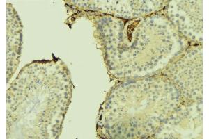 ABIN6275011 at 1/100 staining Mouse testis tissue by IHC-P. (CHPF 抗体  (C-Term))