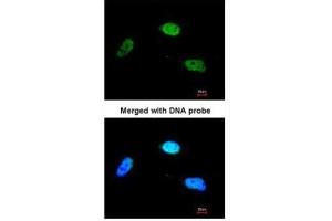 ICC/IF Image Immunofluorescence analysis of paraformaldehyde-fixed HeLa, using ZNF398, antibody at 1:200 dilution. (ZNF398 抗体)