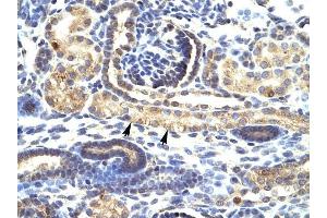 SNAI1 antibody was used for immunohistochemistry at a concentration of 4-8 ug/ml to stain Epithelial cells of renal tubule (arrows) in Human Kidney.