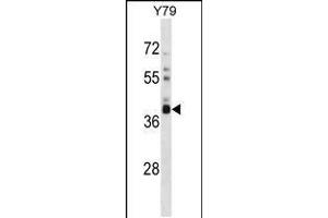 Western blot analysis in Y79 cell line lysates (35ug/lane). (OR52L1 抗体  (C-Term))
