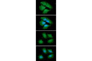 ICC/IF analysis of 14-3-3 epsilon in HeLa cells line, stained with DAPI (Blue) for nucleus staining and monoclonal anti-human 14-3-3 epsilon antibody (1:100) with goat anti-mouse IgG-Alexa fluor 488 conjugate (Green). (YWHAE 抗体)