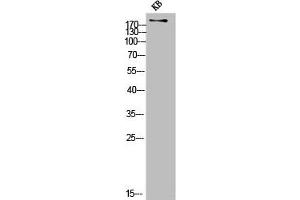 Western Blot analysis of KB cells using COL11A1 Polyclonal Antibody (COL11A1 抗体  (Internal Region))