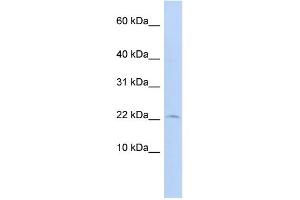 WB Suggested Anti-FKBP2 Antibody Titration: 0. (FKBP2 抗体  (N-Term))
