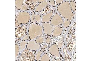 IHC analysis of U1A/SNRPA using anti-U1A/SNRPA antibody (ABIN7600891). (SNRPA1 抗体  (AA 25-218))