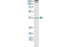 PURA monoclonal antibody (M01), clone 3F10.