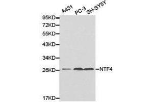 Western Blotting (WB) image for anti-Neurotrophin 4 (NTF4) antibody (ABIN1873969) (Neurotrophin 4 抗体)