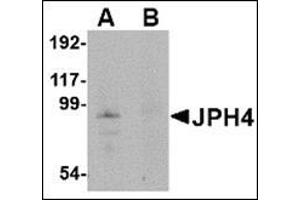 Western blot analysis of JPH4 in mouse brain tissue lysate with this product at 1 μg/ml in (A) the absence and (B) the presence of blocking peptide. (Junctophilin 4 抗体  (Middle Region))