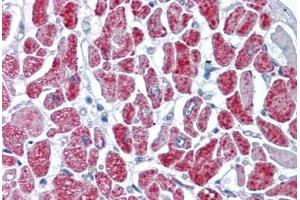 Human Heart: Formalin-Fixed, Paraffin-Embedded (FFPE) (GMP Synthase 抗体  (AA 108-216))
