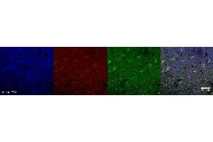 Immunohistochemistry (IHC) image for anti-Glutaminase (GLS) antibody (ABIN7456168) (Glutaminase 抗体)