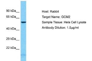 Host: Rabbit Target Name: GCM2 Sample Tissue: Human Hela Whole Cell Antibody Dilution: 1ug/ml (GCM2 抗体  (N-Term))