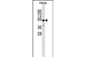 ZSCAN4 Antibody (N-term) (ABIN1539656 and ABIN2849832) western blot analysis in Hela cell line lysates (35 μg/lane). (ZSCAN4 抗体  (N-Term))