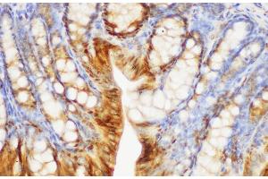 Immunohistochemistry of paraffin-embedded Mouse colon using S100A6 Polycloanl Antibody at dilution of 1:150 (S100A6 抗体)