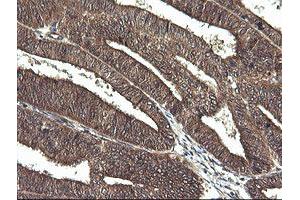 Image no. 4 for anti-Cancer/testis Antigen 1B (CTAG1B) antibody (ABIN1499895)