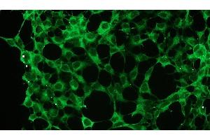 Immunocytochemistry (ICC) image for anti-Protein Kinase C, zeta (PRKCZ) antibody (ABIN870323) (PKC zeta 抗体)