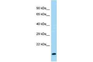 WB Suggested Anti-Gm8008 Antibody Titration: 1. (Gm8008 抗体  (C-Term))