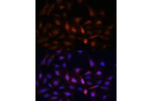 Immunofluorescence analysis of U-2 OS cells using PSM antibody (ABIN1682332, ABIN3018467, ABIN3018468 and ABIN6220474) at dilution of 1:100.