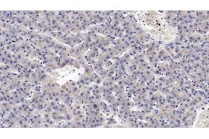 Detection of MASP2 in Human Liver Tissue using Monoclonal Antibody to Mannose Associated Serine Protease 2 (MASP2) (Mannose Associated Serine Protease 2 (AA 170-287) 抗体)
