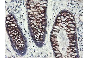 Immunohistochemistry (IHC) image for anti-Golgi Membrane Protein 1 (GOLM1) antibody (ABIN1498491) (GOLM1 抗体)