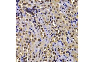Immunohistochemistry of paraffin-embedded mouse kidney using WHSC1 antibody (ABIN6128925, ABIN6150213, ABIN6150214 and ABIN6223939) at dilution of 1:100 (40x lens). (WHSC1 抗体  (AA 1-240))