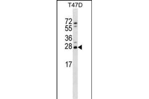 ZT2 Antibody (C-term) (ABIN656733 and ABIN2845957) western blot analysis in T47D cell line lysates (35 μg/lane). (ZMAT2 抗体  (C-Term))