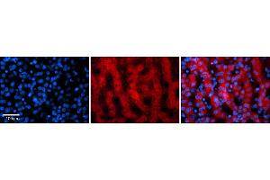 Rabbit Anti-PAntibody    Formalin Fixed Paraffin Embedded Tissue: Human Adult liver  Observed Staining: Cytoplasmic Primary Antibody Concentration: 1:100 Secondary Antibody: Donkey anti-Rabbit-Cy2/3 Secondary Antibody Concentration: 1:200 Magnification: 20X Exposure Time: 0. (PARP16 抗体  (N-Term))
