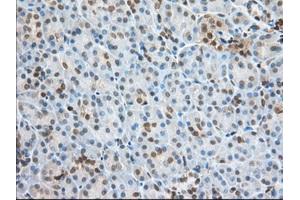 Immunohistochemical staining of paraffin-embedded Human Kidney tissue using anti-PFN1 mouse monoclonal antibody. (PFN1 抗体)