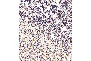 Immunohistochemical analysis of paraffin-embedded H. (FOXP1 抗体  (C-Term))