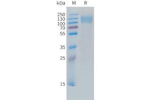 Cynomolgus CEA Protein, His Tag on SDS-PAGE under reducing condition.