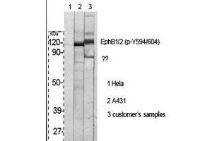 Western Blot (WB) analysis of specific cells using Phospho-EphB1/2 (Y594/604) Polyclonal Antibody. (EPHB1/2 抗体  (pTyr594, pTyr604))