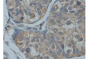 Immunohistochemical staining of formalin-fixed paraffin-embedded human fetal testis tissue showing membrane staining with ADAM30 polyclonal antibody  at 1 : 100 dilution. (ADAM30 抗体  (Internal Region))