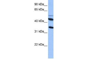 WB Suggested Anti-IL13RA2 Antibody Titration: 0. (IL13RA2 抗体  (Middle Region))