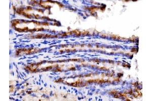IHC analysis of AGPAT2 using anti-AGPAT2 antibody (ABIN7602435). (AGPAT2 抗体  (AA 77-178))