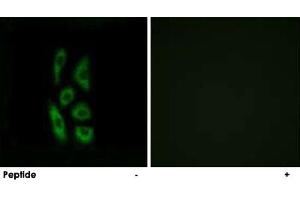 Immunofluorescence analysis of A-549 cells, using ACOT12 polyclonal antibody . (ACOT12 抗体)