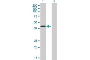 Western Blot analysis of TMOD3 expression in transfected 293T cell line by TMOD3 MaxPab polyclonal antibody. (TMOD3 抗体  (AA 1-352))