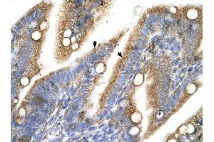 Immunohistochemistry (IHC) image for anti-Transient Receptor Potential Cation Channel, Subfamily M, Member 5 (TRPM5) (N-Term) antibody (ABIN630115)