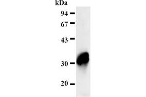 Western Blotting (WB) image for anti-Four and A Half LIM Domains 2 (FHL2) antibody (ABIN487469) (FHL2 抗体)