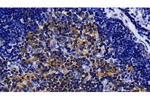 Detection of TLR5 in Rat Thymus Tissue using Polyclonal Antibody to Toll Like Receptor 5 (TLR5) (TLR5 抗体  (AA 325-644))
