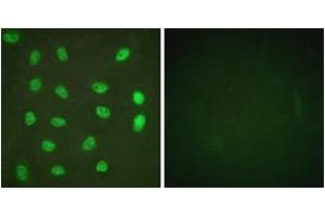 Immunofluorescence analysis of HeLa cells treated with PMA 125ng/ml 30', using MEF2A (Phospho-Ser408) Antibody. (MEF2A 抗体  (pSer408))