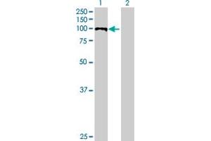 Western Blot analysis of PDCD6IP expression in transfected 293T cell line by PDCD6IP MaxPab polyclonal antibody. (ALIX 抗体  (AA 1-868))