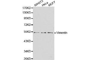 Western blot analysis of extracts of various cell lines, using VIM antibody. (Vimentin 抗体)